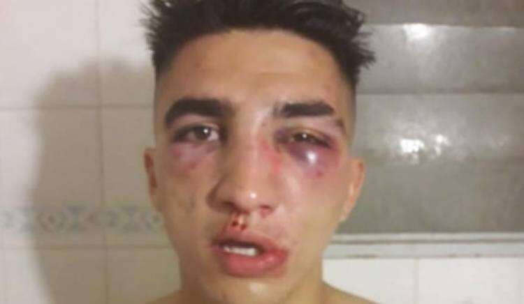 La Policía identificó a los menores que golpearon brutalmente a dos personas 