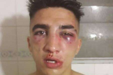 La Policía identificó a los menores que golpearon brutalmente a dos personas 